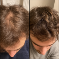 MACLINIC_m4clinic_profesjonalny_szampon_odzywka_do_wlosow_efekty_mężczyzna_4.png
