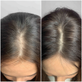 MACLINIC_m4clinic_profesjonalny_szampon_odzywka_do_wlosow_efekty_kobieta.png