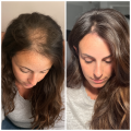 MACLINIC_m4clinic_profesjonalny_szampon_odzywka_do_wlosow_efekty_kobieta_2.png