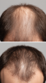 MACLINIC_m4clinic_profesjonalny_szampon_odzywka_do_wlosow_efekty_mężczyzna.png