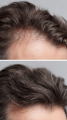 MACLINIC_m4clinic_profesjonalny_szampon_odzywka_do_wlosow_efekty_mężczyzna_2.png
